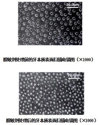 牙科脫敏劑注冊(cè)審查指導(dǎo)原則（2021年第102號(hào)）(圖2)